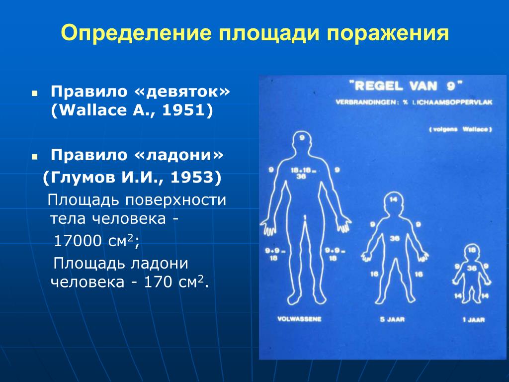 Правило девяток. Площадь поражения правило девяток. Правило девяток Уоллеса. Площадь тела правило девяток. Площадь поражения правило ладони.